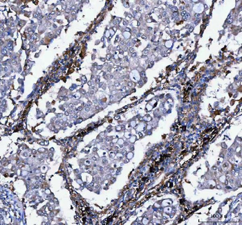 LDAH Antibody