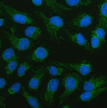 LCMT2 Antibody