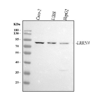 Anti-LRRN4 Antibody