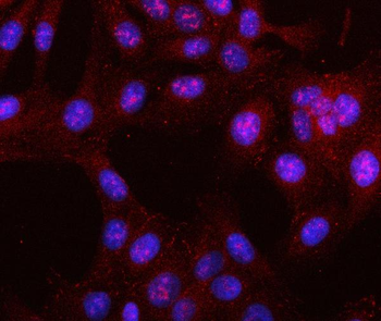 Anti-LRRN4 Antibody