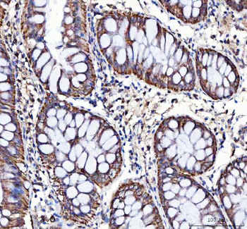 Anti-LRRN4 Antibody
