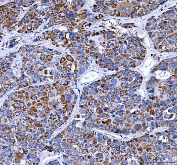 Anti-LRRN4 Antibody