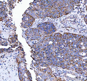 Anti-LRRN4 Antibody