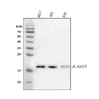 Anti-LAGE3 Antibody