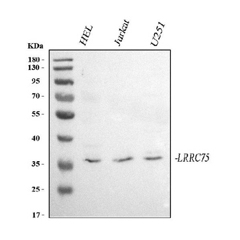 Anti-LRRC75A Antibody