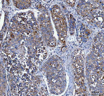 Anti-LRRC75B Antibody