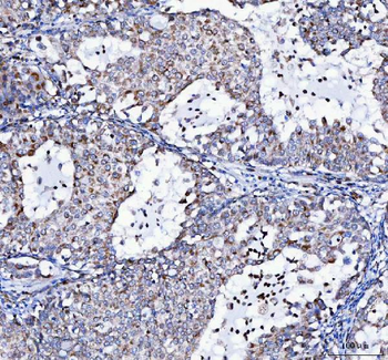 Anti-LRRC75B Antibody