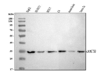 Anti-LRRC75B Antibody