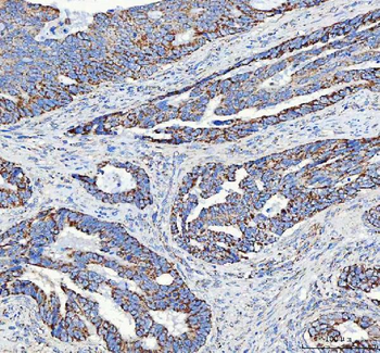 Anti-ATP5F1D Antibody