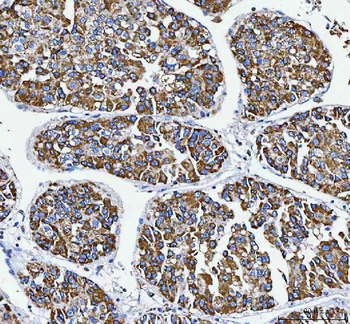 Anti-ATP5F1D Antibody