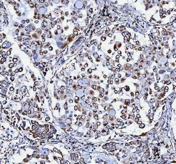 Anti-ATP5F1D Antibody