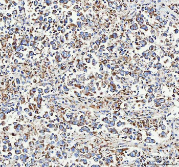 Anti-ATP5F1D Antibody