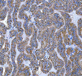 Anti-ATP5F1D Antibody