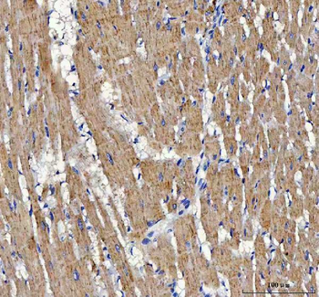 Anti-ATP5F1D Antibody