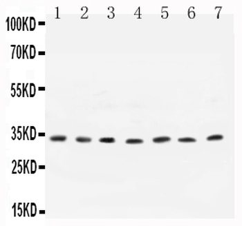 Cyclin D1/CCND1 Antibody