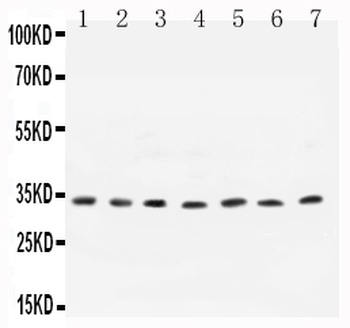 Anti-Cyclin D1/CCND1 Antibody