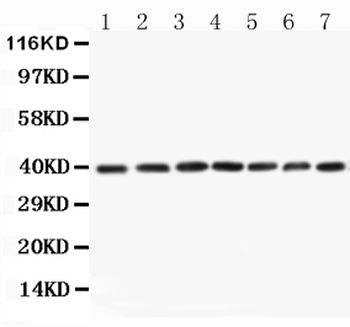 MEK3/MAP2K3 Rabbit Polyclonal Antibody