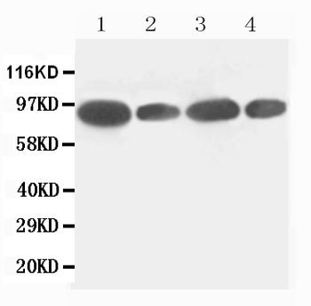 FES Rabbit Polyclonal Antibody