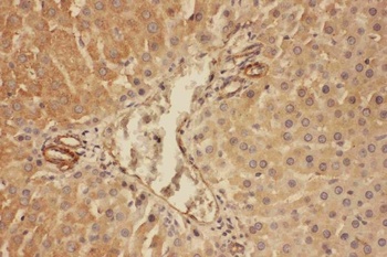 Anti-C5/C5a Antibody