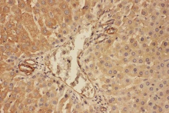 C5/C5a Antibody