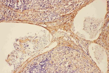 Anti-C5/C5a Antibody
