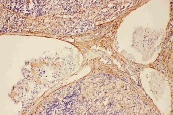 C5/C5a Antibody