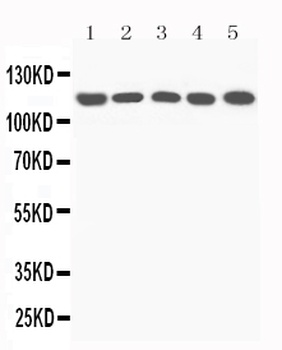 Anti-C5/C5a Antibody