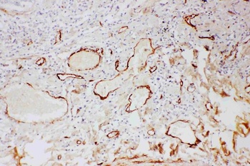 Anti-Adiponectin/ADIPOQ Antibody