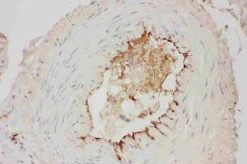 Anti-Adiponectin/ADIPOQ Antibody