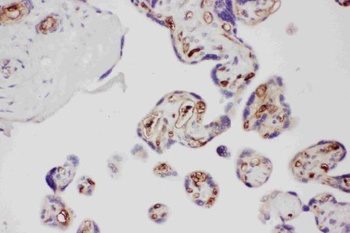 Anti-Adiponectin/ADIPOQ Antibody