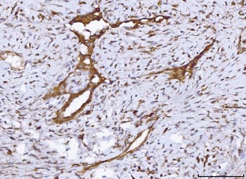 COX1/Cyclooxygenase 1/PTGS1 Antibody