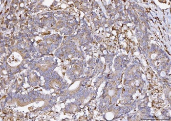 Anti-COX1/Cyclooxygenase 1/PTGS1 Antibody