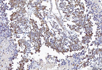 Anti-COX1/Cyclooxygenase 1/PTGS1 Antibody
