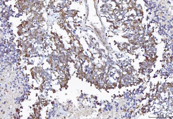 COX1/Cyclooxygenase 1/PTGS1 Antibody