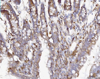 Anti-COX1/Cyclooxygenase 1/PTGS1 Antibody