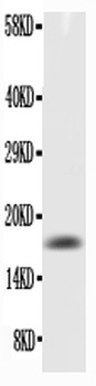 GM-CSF/CSF2 Antibody