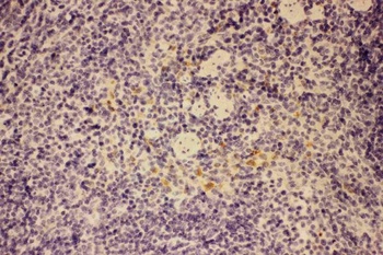 Anti-GM-CSF/CSF2 Antibody