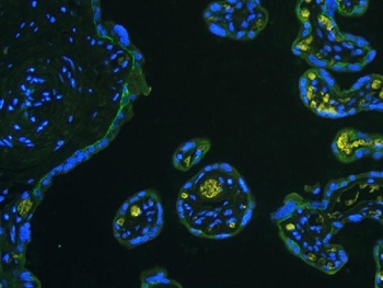 Anti-Integrin beta 4/ITGB4 Antibody