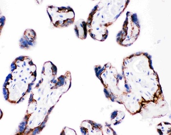 Anti-Integrin beta 4/ITGB4 Antibody