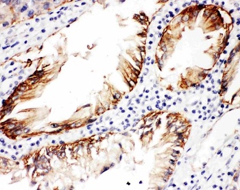 Anti-Integrin beta 4/ITGB4 Antibody