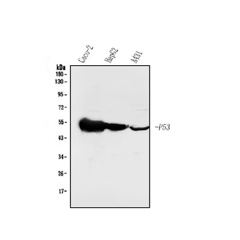 P53/TP53 Antibody