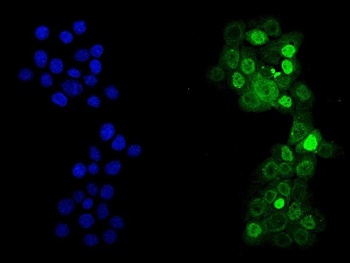 P53/TP53 Antibody