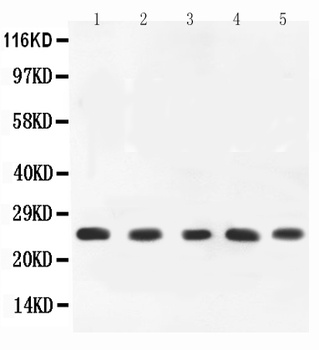 TNF alpha Antibody