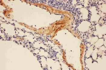Anti-Adiponectin/ADIPOQ Antibody