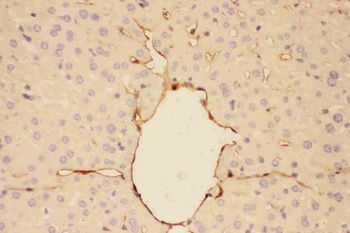 Anti-Adiponectin/ADIPOQ Antibody