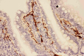 Anti-Adiponectin/ADIPOQ Antibody