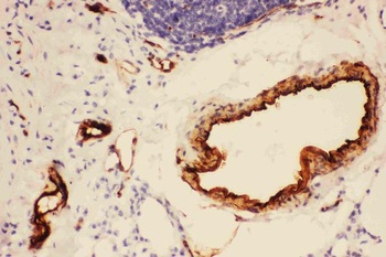 Anti-Adiponectin/ADIPOQ Antibody