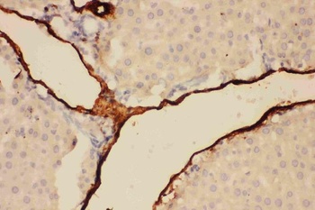 Anti-Adiponectin/ADIPOQ Antibody