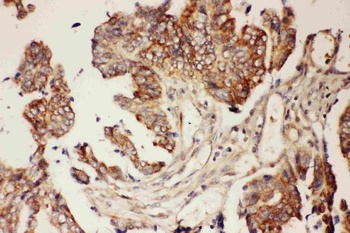 Anti-CNTF Antibody