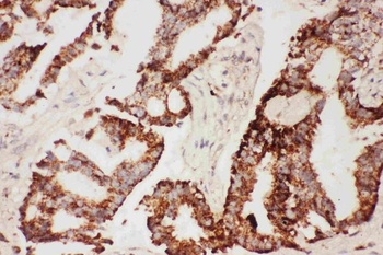 Anti-CNTF Antibody